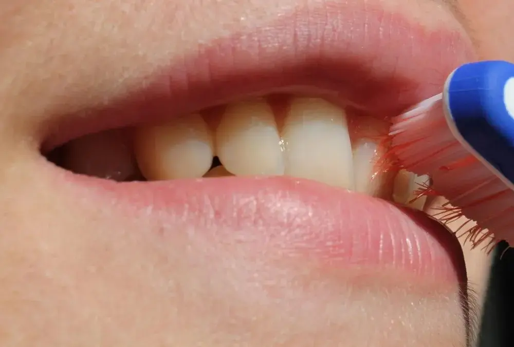 Jak wykonać pędzlowanie jamy ustnej, aby skutecznie zwalczyć pleśniawki