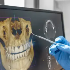 Dentysta analizuje obraz CBCT, pokazujący trójwymiarowy model szczęki. CBCT co to? To nowoczesna metoda diagnostyki obrazowej w stomatologii.