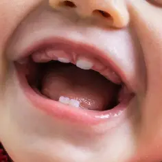 Uśmiechnięte dziecko z kilkoma ząbkami. Pytanie o późne ząbkowanie przyczyny.
