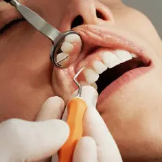 Dentysta bada jamę ustną, widoczne są zęby i dziąsła. Narzędzia stomatologiczne pomagają ocenić stan dziąseł, czy nie ma zerwanych szwów.
