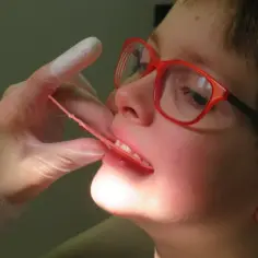 Chłopiec w okularach z czerwonymi oprawkami ma badany zgryz. Dentysta w rękawiczce delikatnie rozchyla usta, by ocenić przodozgryz.
