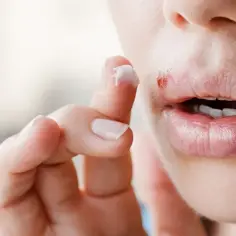 Czy z zimnem można iść do dentysty? Ryzyko i ważne informacje
