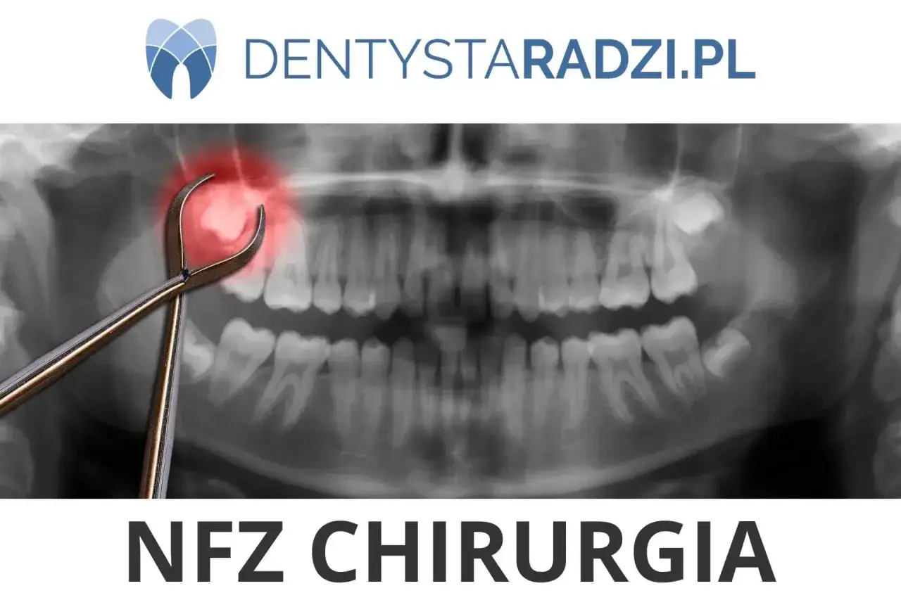 Rentgen szczęki z kleszczami dentystycznymi nad bolącym zębem. Symbolizuje zabieg kiretaż otwarty. NFZ CHIRURGIA.