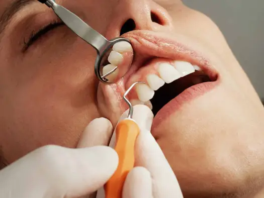 Zerwane szwy na dziąśle - kiedy to norma, a kiedy do dentysty?