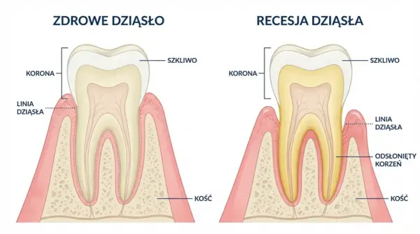 Zdrowe dziąsła - jak rozpoznać problem i zareagować?