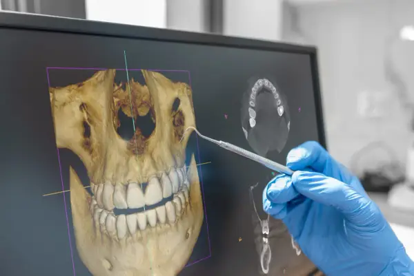CBCT zębów - kiedy tomografia 3D ma sens?