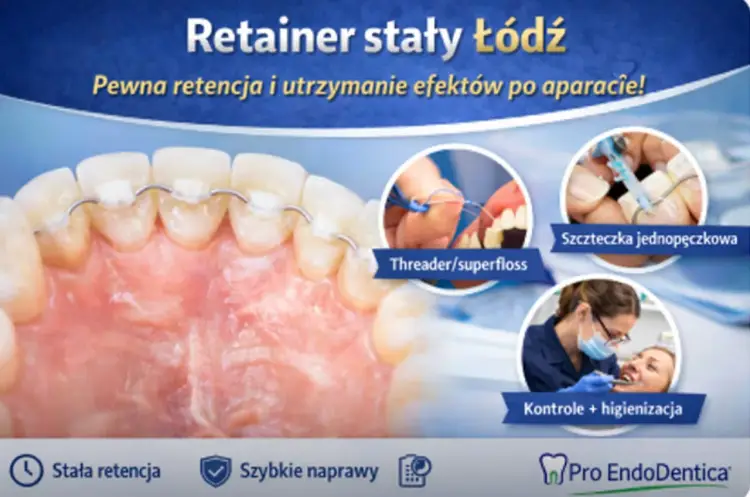 Retainer po polsku - co to jest i jak utrzymać efekt leczenia?